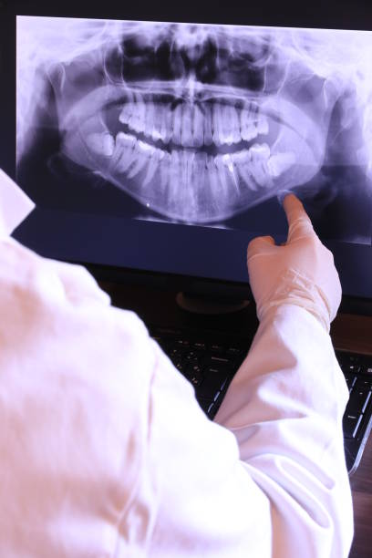 Best Emergency Root Canal Treatment in Woodmore, MD