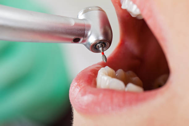 Best Walk-In Emergency Dentist in Woodmore, MD